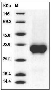 Human CD32a / FCGR2A Protein (167 His) (His & AVI Tag) SDS-PAGE