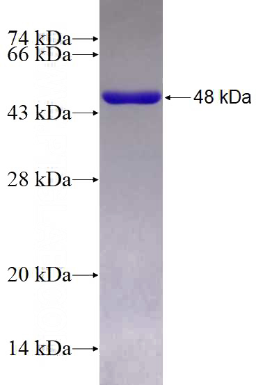 Recombinant Human NDC80 SDS-PAGE