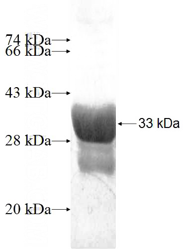 Recombinant Human PSD3 SDS-PAGE