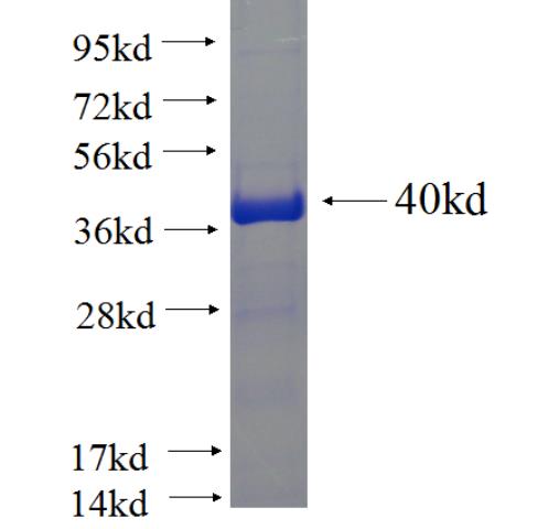 Recombinant human KBTBD5 SDS-PAGE
