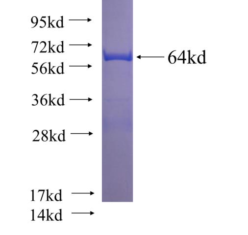 Recombinant human BAG5 SDS-PAGE