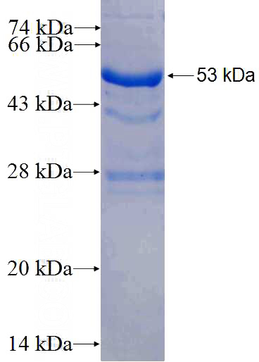 Recombinant Human ULK2 SDS-PAGE