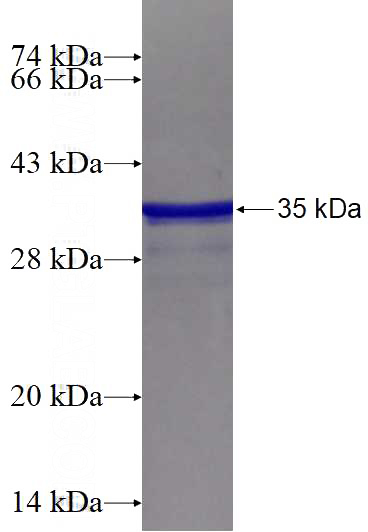 Recombinant Human SMARCA4 SDS-PAGE