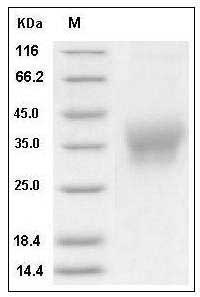 Human Ephrin-B2 (His Tag) recombinant protein