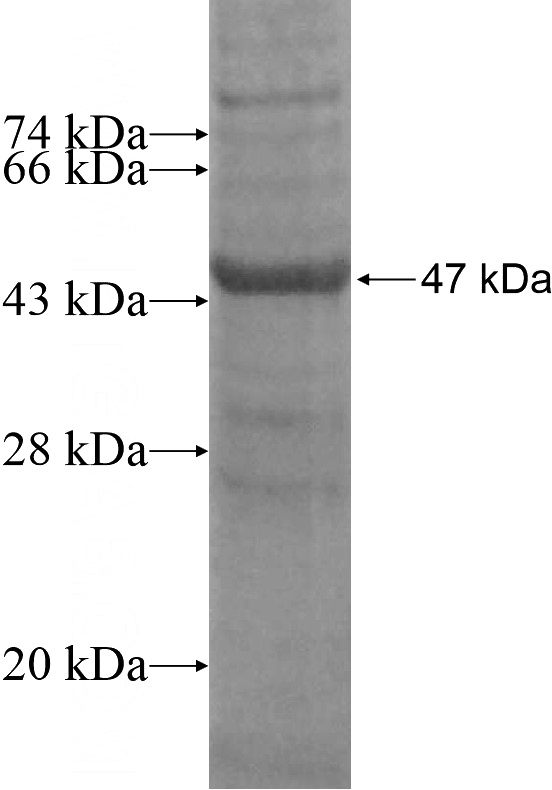 Recombinant Human ZNF583 SDS-PAGE