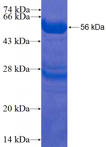 Recombinant Human SPIN1 SDS-PAGE