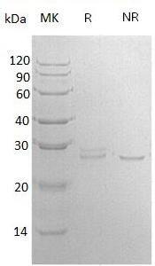 Human APCS/PTX2 (His tag) recombinant protein
