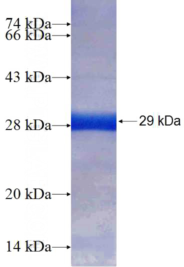 Recombinant Human SSU72 SDS-PAGE