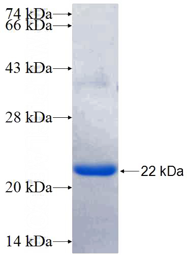 Recombinant Human ANGPTL1 SDS-PAGE