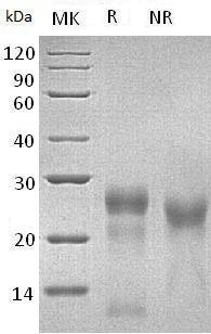 Mouse Tnfrsf11a/Rank (His tag) recombinant protein
