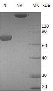 Mouse Pdcd1lg2/B7dc/Btdc/Cd273/Pdl2 (Fc tag) recombinant protein