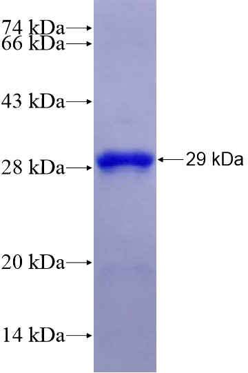 Recombinant Human EEA1 SDS-PAGE