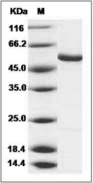 Human DPYS / Dihydropyrimidinase Protein SDS-PAGE