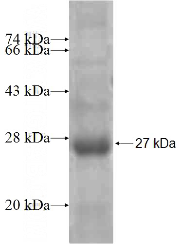 Recombinant Human KRTAP4-12 SDS-PAGE