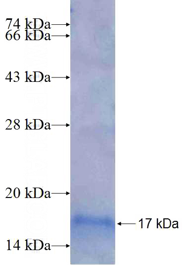 Recombinant Human SLC22A8 SDS-PAGE