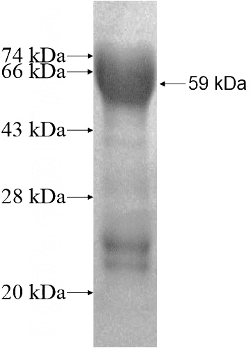 Recombinant Human CDON SDS-PAGE