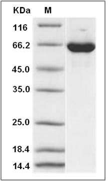 Mouse ERK2 / MAPK1 / MAPK2 Protein (His & GST Tag) SDS-PAGE