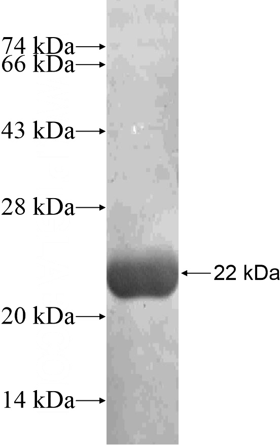 Recombinant Human ZNF154 SDS-PAGE