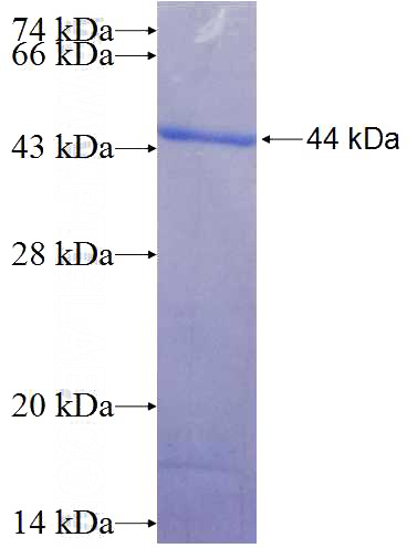 Recombinant Human CDC27; APC3 SDS-PAGE