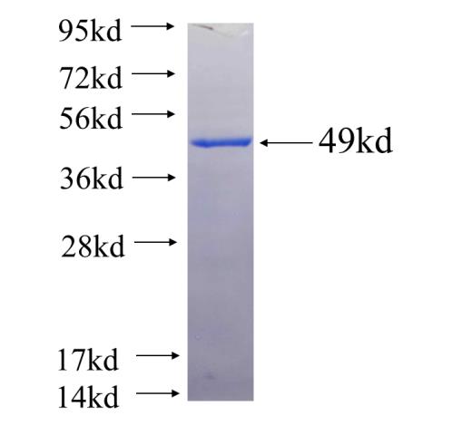 Recombinant human RAB5C(Full length) SDS-PAGE