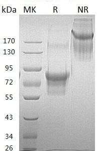 Human HAVCR2/TIM3/TIMD3 (Fc & His tag) recombinant protein