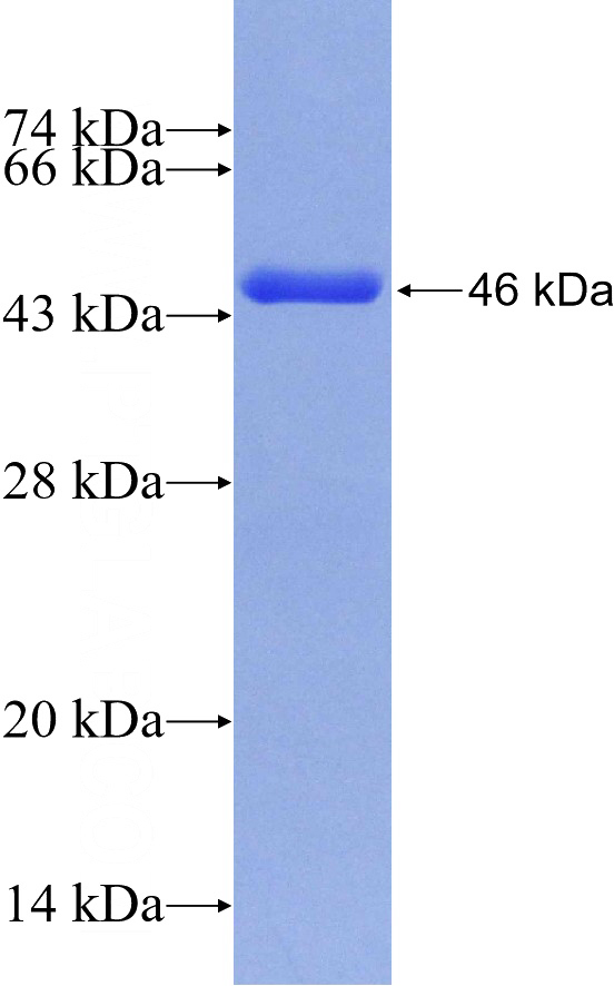 Recombinant Human AGL SDS-PAGE
