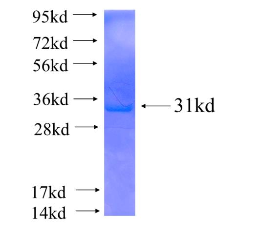 Recombinant human FANCG SDS-PAGE