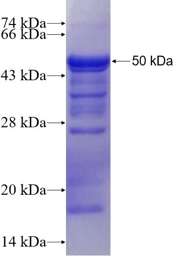 Recombinant Human RABGAP1L SDS-PAGE