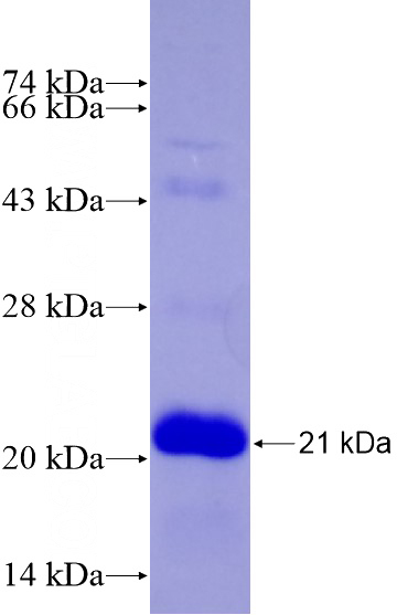 Recombinant Human LMO2 SDS-PAGE