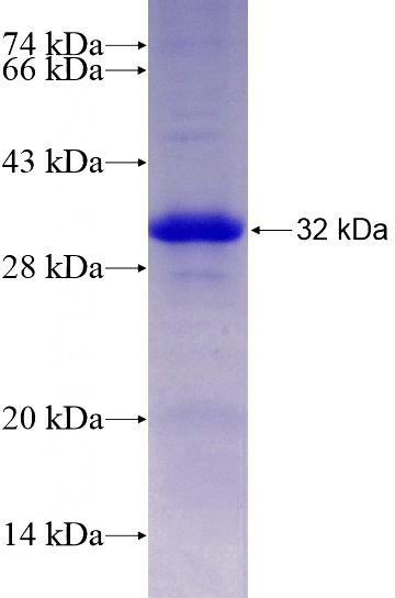Recombinant Human LENG8 SDS-PAGE