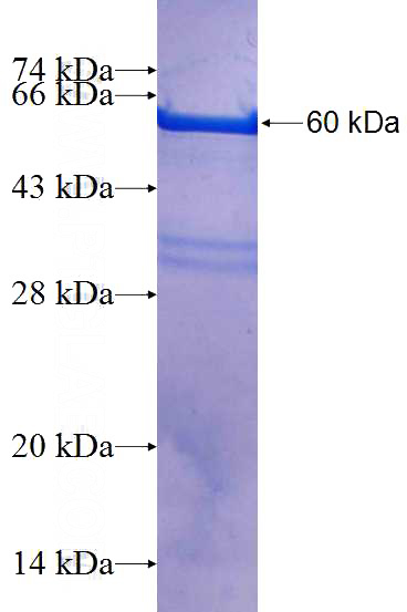 Recombinant Human CXorf26 SDS-PAGE
