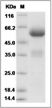 Human PIK3IP1 Protein (Fc Tag) SDS-PAGE