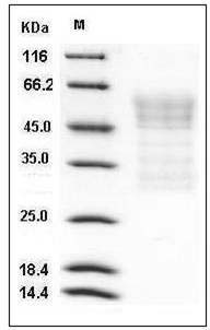 Mouse Syndecan-1 / SDC1 / CD138 Protein (His Tag) SDS-PAGE