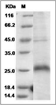Human CD27 / TNFRSF7 Protein (His Tag) SDS-PAGE