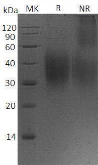 Mouse Cd47 (His tag) recombinant protein