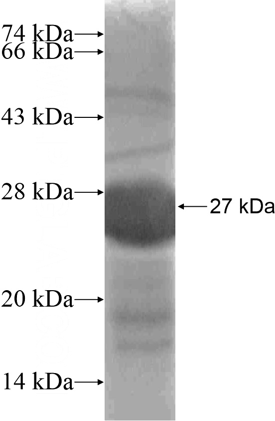Recombinant Human RHBDL1 SDS-PAGE