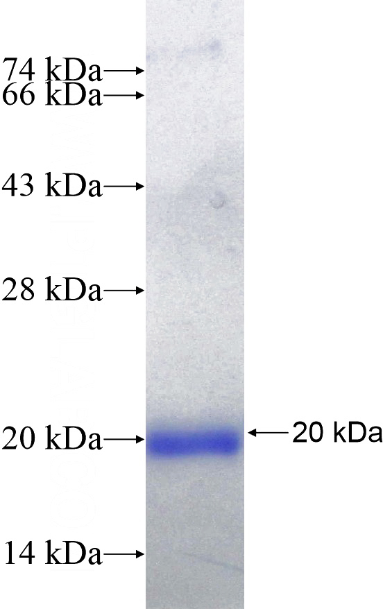 Recombinant Human Integrin beta-6 SDS-PAGE