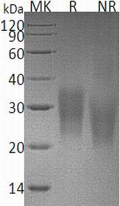 Mouse Fas/Apt1/Tnfrsf6 (His tag) recombinant protein