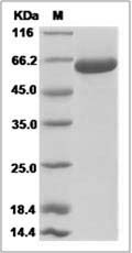 Rat EphB3 / HEK2 / Eph Receptor B3 Protein (His Tag)