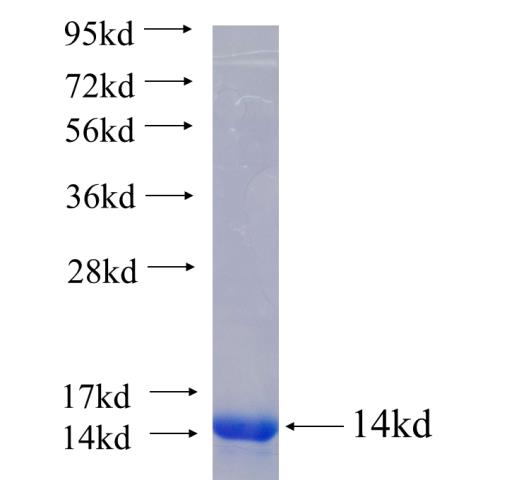 Recombinant human PYY(Full length) SDS-PAGE