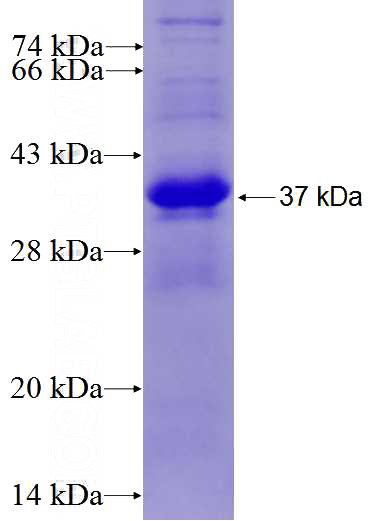 Recombinant Human RASA3 SDS-PAGE