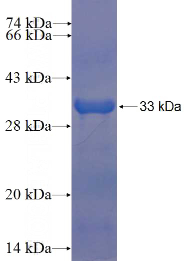 Recombinant Human PLAGL1 SDS-PAGE