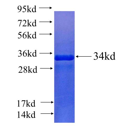 Recombinant human PKIG(Full length) SDS-PAGE