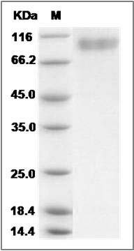 Rat Thrombomodulin / THBD Protein (His Tag) SDS-PAGE