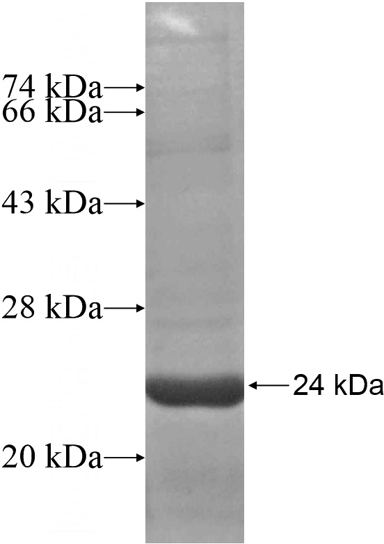 Recombinant Human RGL4 SDS-PAGE