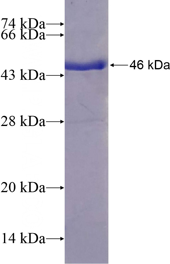 Recombinant Human TXNDC5 SDS-PAGE