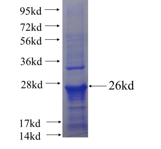 Recombinant human LRFN4 SDS-PAGE