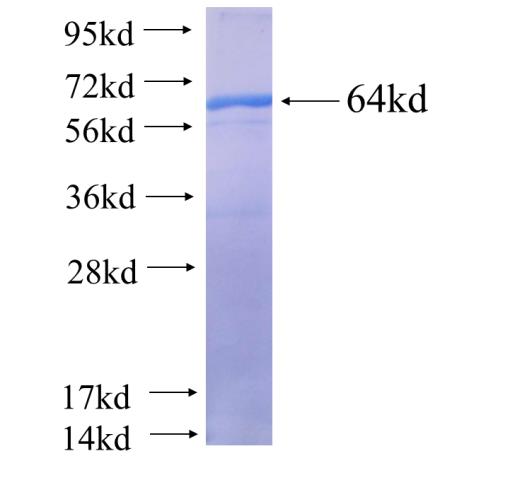 Recombinant human KPNA6 SDS-PAGE