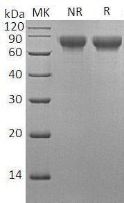 Rat Kitlg/Kitl/Mgf (His tag) recombinant protein