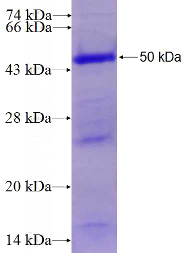 Recombinant Human PDGFD SDS-PAGE